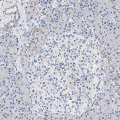 Immunohistochemistry-Paraffin: ECHDC2 Antibody [NBP1-83803]
