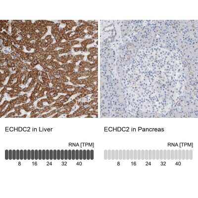 Immunohistochemistry-Paraffin: ECHDC2 Antibody [NBP1-83803]