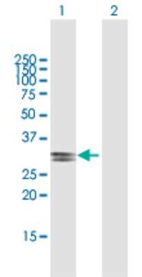 Western Blot: ECHDC2 Antibody [H00055268-B01P]