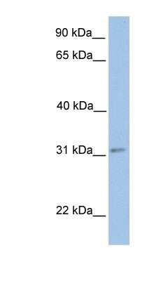 Western Blot: ECHDC2 Antibody [NBP1-79297]