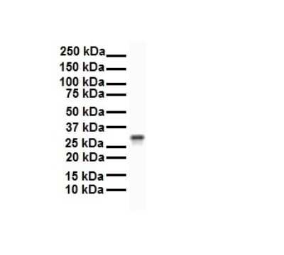 Western Blot: ECHDC2 Antibody [NBP1-79298]