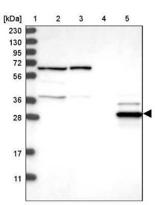 Western Blot: ECHDC2 Antibody [NBP1-83803]