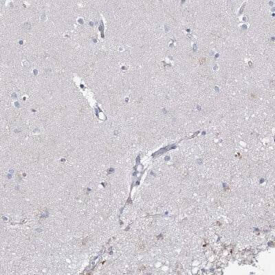 Immunohistochemistry-Paraffin: ECHDC3 Antibody [NBP1-82159]