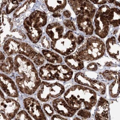 Immunohistochemistry-Paraffin: ECHDC3 Antibody [NBP1-82159]