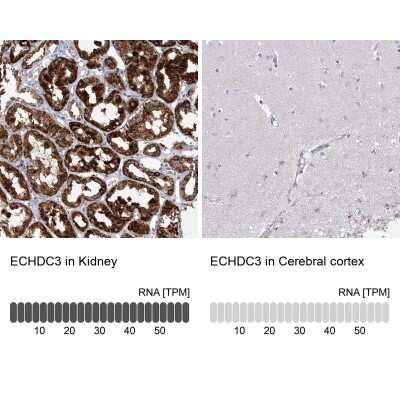 Immunohistochemistry-Paraffin: ECHDC3 Antibody [NBP1-82159]