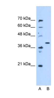 Western Blot: ECHDC3 Antibody [NBP1-79302]