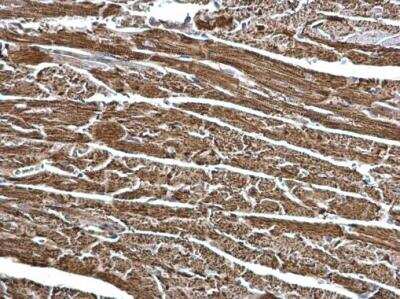 Immunohistochemistry-Paraffin: ECHS1 Antibody [NBP2-16263]