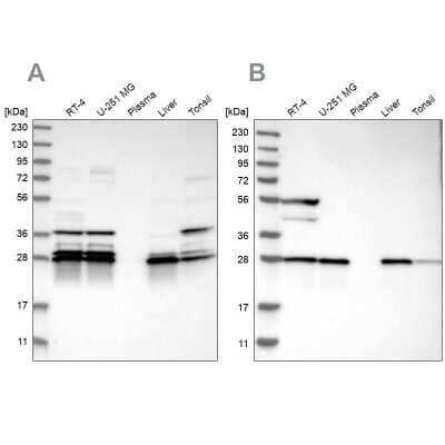 Western Blot: ECHS1 Antibody [NBP1-87078]