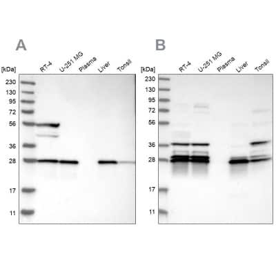 Western Blot: ECHS1 Antibody [NBP1-87079]