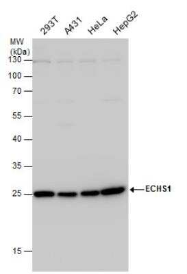 Western Blot: ECHS1 Antibody [NBP2-16263]