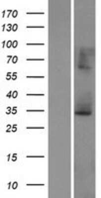 Western Blot: ECHS1 Overexpression Lysate [NBP2-07913]