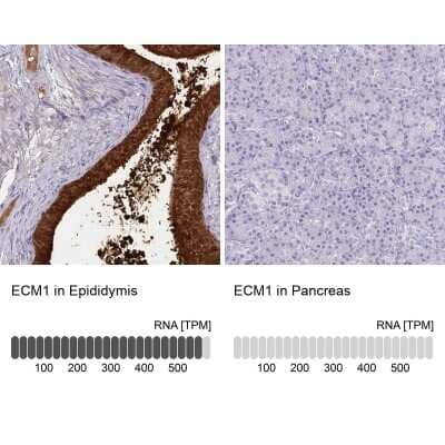 Immunohistochemistry-Paraffin: ECM-1/Secretory Component P85 Antibody [NBP1-87449]