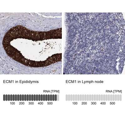Immunohistochemistry-Paraffin: ECM-1/Secretory Component P85 Antibody [NBP3-16986]