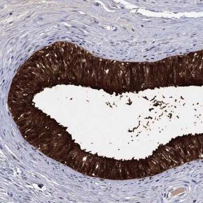 Immunohistochemistry-Paraffin: ECM-1/Secretory Component P85 Antibody [NBP3-16986]