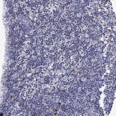 Immunohistochemistry-Paraffin: ECM-1/Secretory Component P85 Antibody [NBP3-16986]