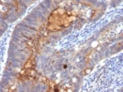 Immunohistochemistry-Paraffin: ECM-1/Secretory Component P85 Antibody (SPM217) - Azide and BSA Free [NBP2-34747]