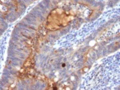 Immunohistochemistry-Paraffin: ECM-1/Secretory Component P85 Antibody (SPM217) [NBP2-32869]