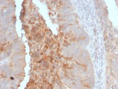 Immunohistochemistry-Paraffin: ECM-1/Secretory Component P85 Antibody (ECM1/792) - IHC-Prediluted [NBP2-48176]