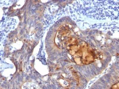 Immunohistochemistry-Paraffin: ECM-1/Secretory Component P85 Antibody (ECM1/792) [NBP2-44397]