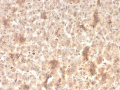 Immunohistochemistry-Paraffin: ECM-1/Secretory Component P85 Antibody (rSPM217) - Azide and BSA Free [NBP3-08403]