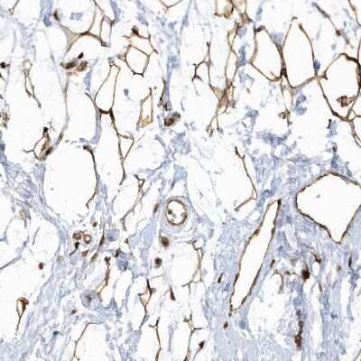 Immunohistochemistry-Paraffin: ECM2 Antibody [NBP1-91004]