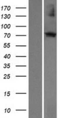 Western Blot: ECM2 Overexpression Lysate [NBP2-08213]