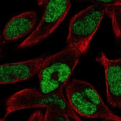 Immunocytochemistry/ Immunofluorescence: ECM29 Antibody [NBP2-14153]