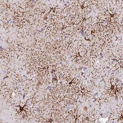 Immunohistochemistry: ECM29 Antibody [NBP2-49304]