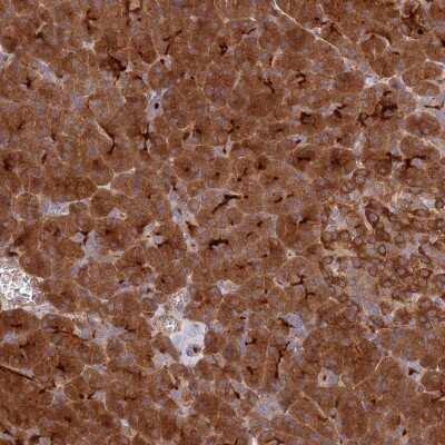 Immunohistochemistry-Paraffin: ECM29 Antibody [NBP2-14153]