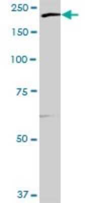 Western Blot: ECM29 Antibody [H00023392-B01P]