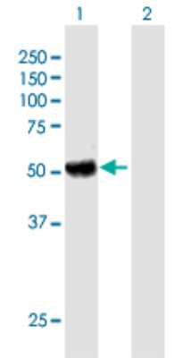 Western Blot: ECM29 Antibody [H00023392-B01P]