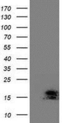 Western Blot: ECRG4 Antibody (OTI3B10) [NBP2-00599]