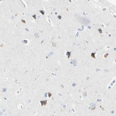 Immunohistochemistry-Paraffin: ECRG4 Antibody [NBP1-84911]