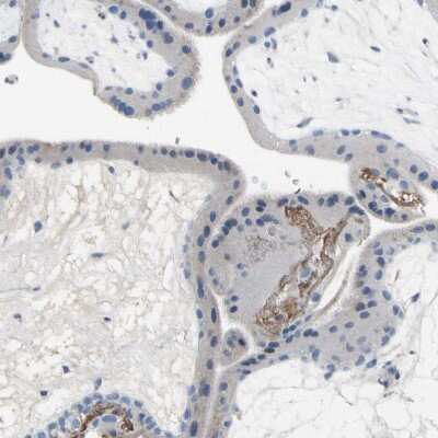 Immunohistochemistry-Paraffin: ECRG4 Antibody [NBP1-84911]