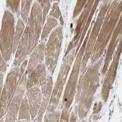 Immunohistochemistry-Paraffin: ECRG4 Antibody [NBP1-84911]