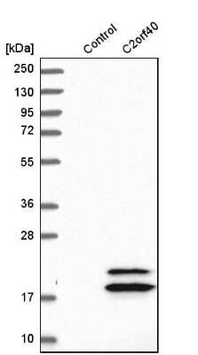 Western Blot: ECRG4 Antibody [NBP1-84911]