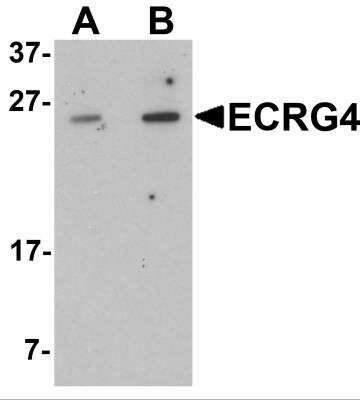 Western Blot: ECRG4 AntibodyBSA Free [NBP2-81925]