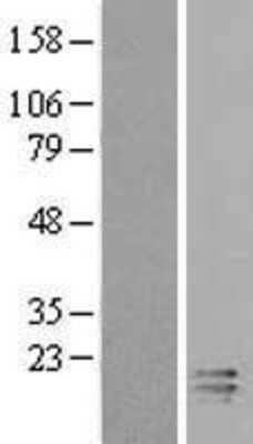 Western Blot: ECRG4 Overexpression Lysate [NBL1-08412]