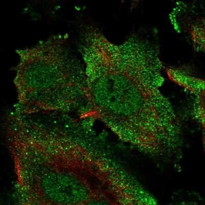 Immunocytochemistry/ Immunofluorescence: ECSCR Antibody [NBP2-68807]