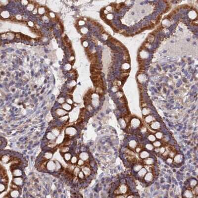 Immunohistochemistry-Paraffin: ECSIT Antibody [NBP1-91858]