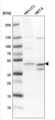Western Blot: ECSIT Antibody [NBP1-91858]