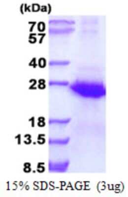 SDS-PAGE: Recombinant Human ECSIT His Protein [NBP2-23017]