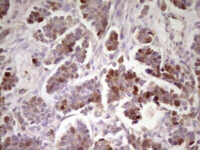 Immunohistochemistry: ECT2 Antibody (OTI2D9) - Azide and BSA Free [NBP2-70613]