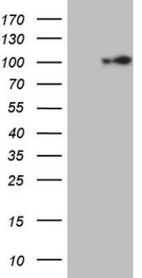 Western Blot: ECT2 Antibody (OTI2D9)Azide and BSA Free [NBP2-70613]