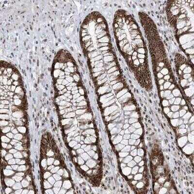 Immunohistochemistry-Paraffin: ECT2L Antibody [NBP1-90847]