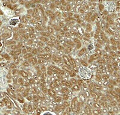 Immunohistochemistry: EDA-A1/Ectodysplasin A1 Antibody - BSA Free [NBP2-81908]