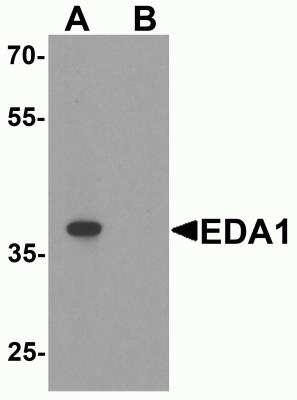 Western Blot: EDA-A1/Ectodysplasin A1 AntibodyBSA Free [NBP2-81908]