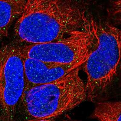 Immunocytochemistry/ Immunofluorescence: EDA/Ectodysplasin Antibody [NBP2-55216]