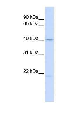 Western Blot: EDA/Ectodysplasin Antibody [NBP1-80536]