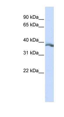 Western Blot: EDA/Ectodysplasin Antibody [NBP1-80537]